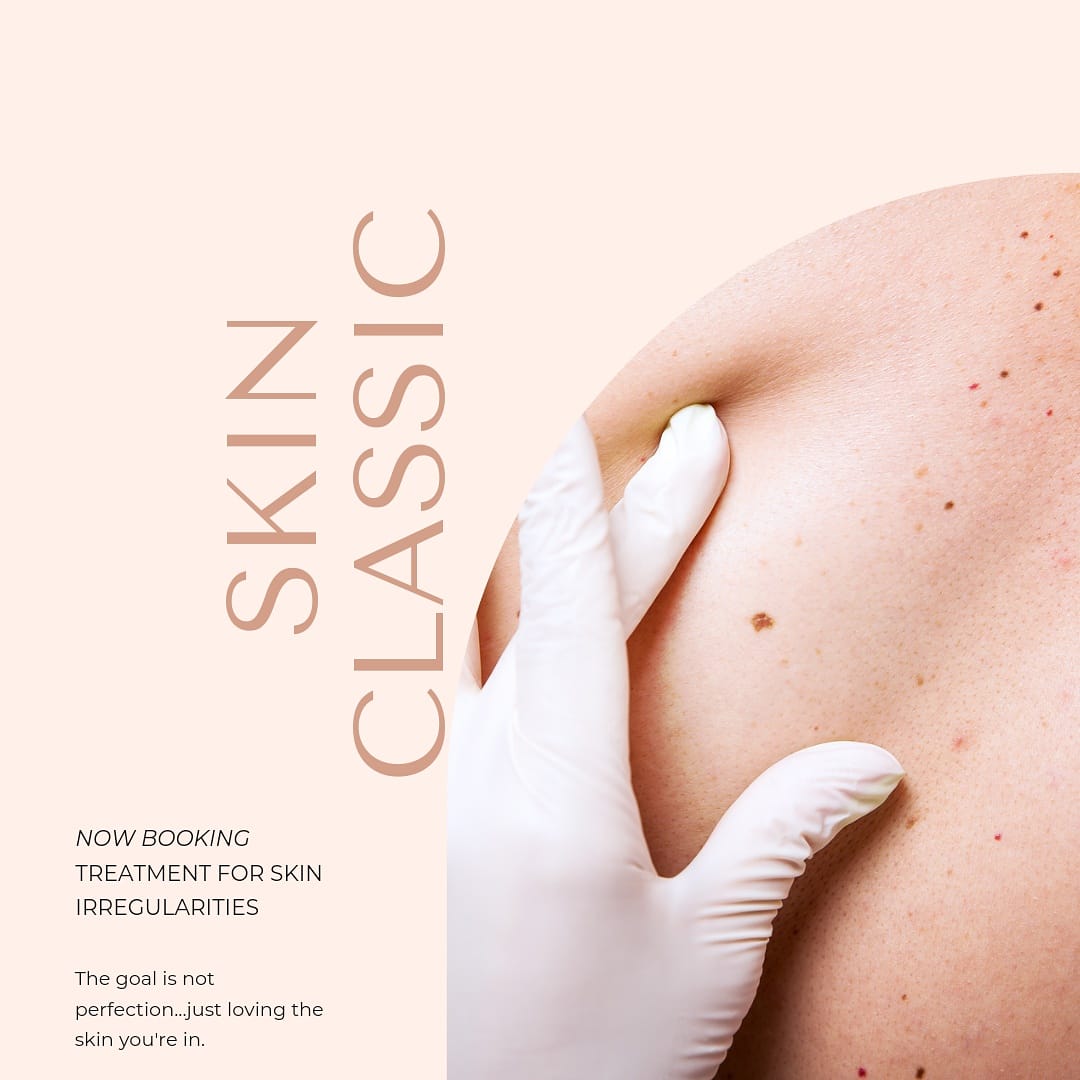 Skin Classic Treatment