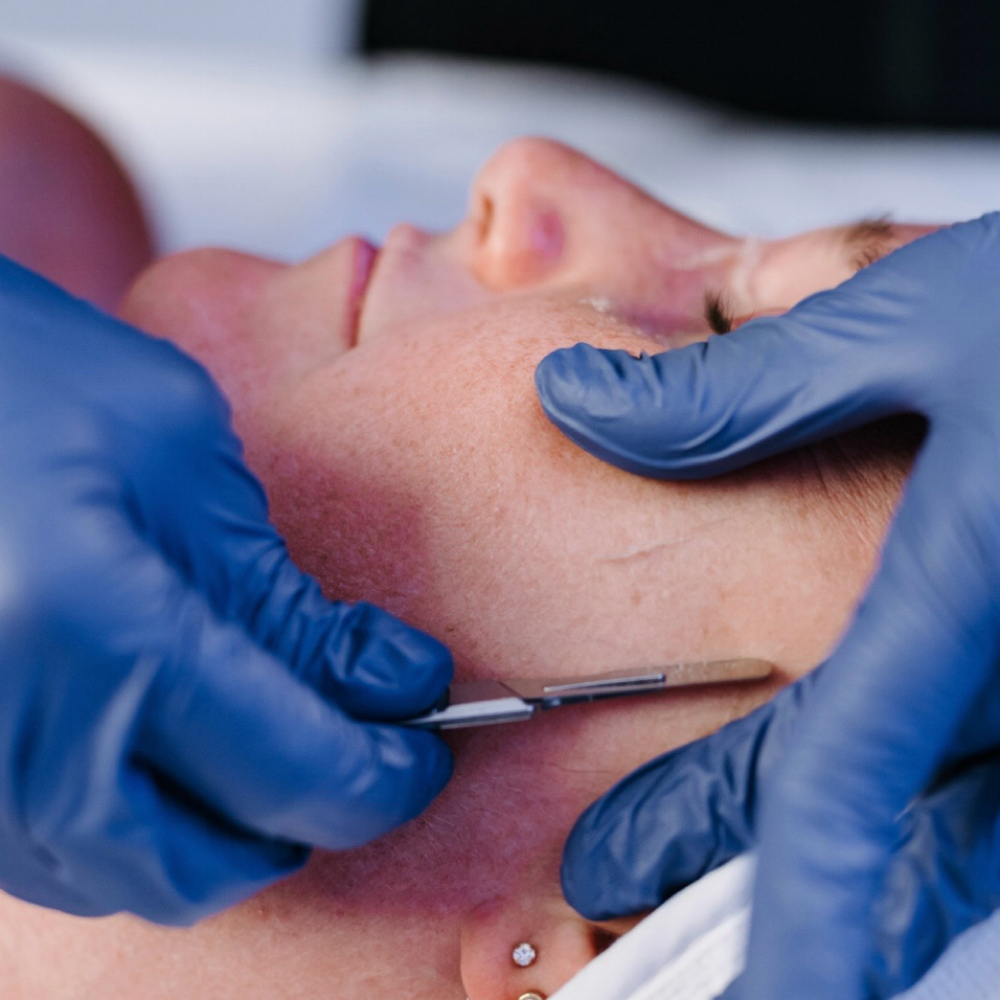 Dermaplane Facial at Dea Litsa Facial Spa in Chicago, IL