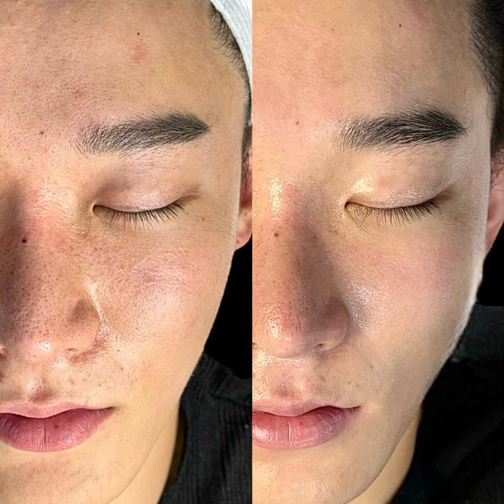 Gentleman's Facial