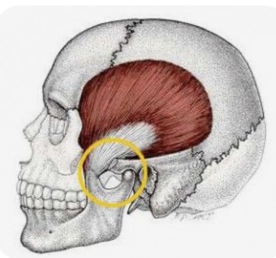 Release (tmj)