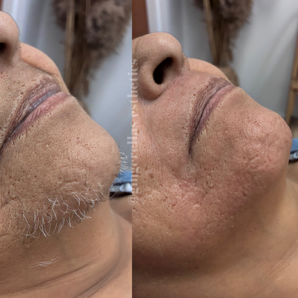 Chin Wax (Middle Area Only) at De Colores Beauty Bar in Chicago, IL