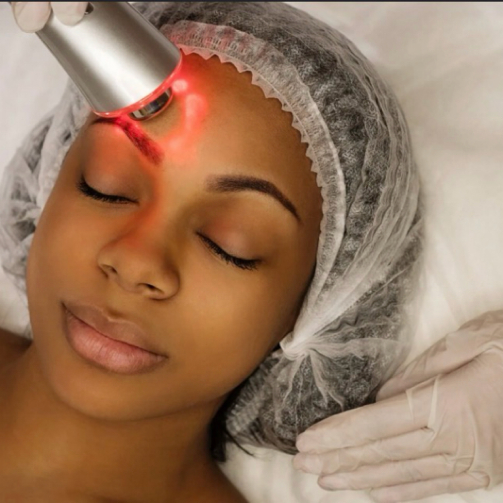 RF  Face Lift at BLAZEBODYSPA & BEAUTY BAR in TINLEY PARK, IL