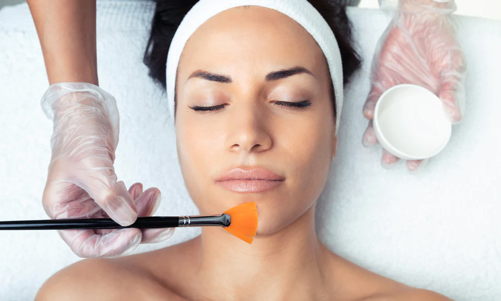 60 Minute Chemical Peel
