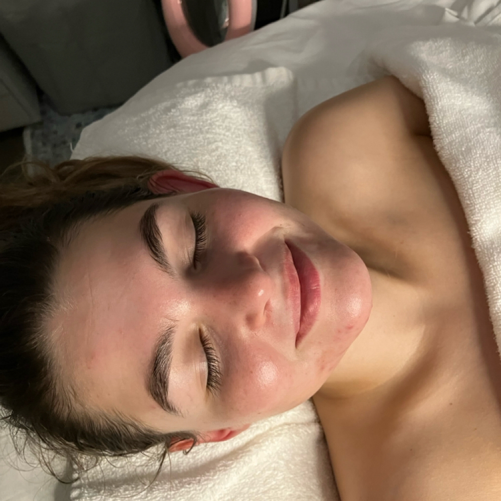 Hyperpigmentation Brighten Facial at Southern Glow Skincare in Augusta, GA