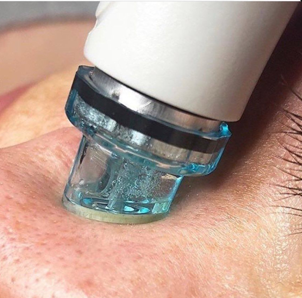 Hydra Breeze Facial. Facial Brisa