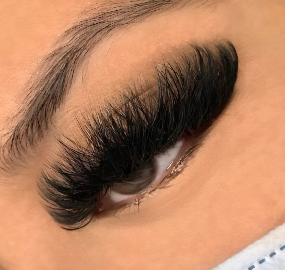 2 Week Mega Volume Fill