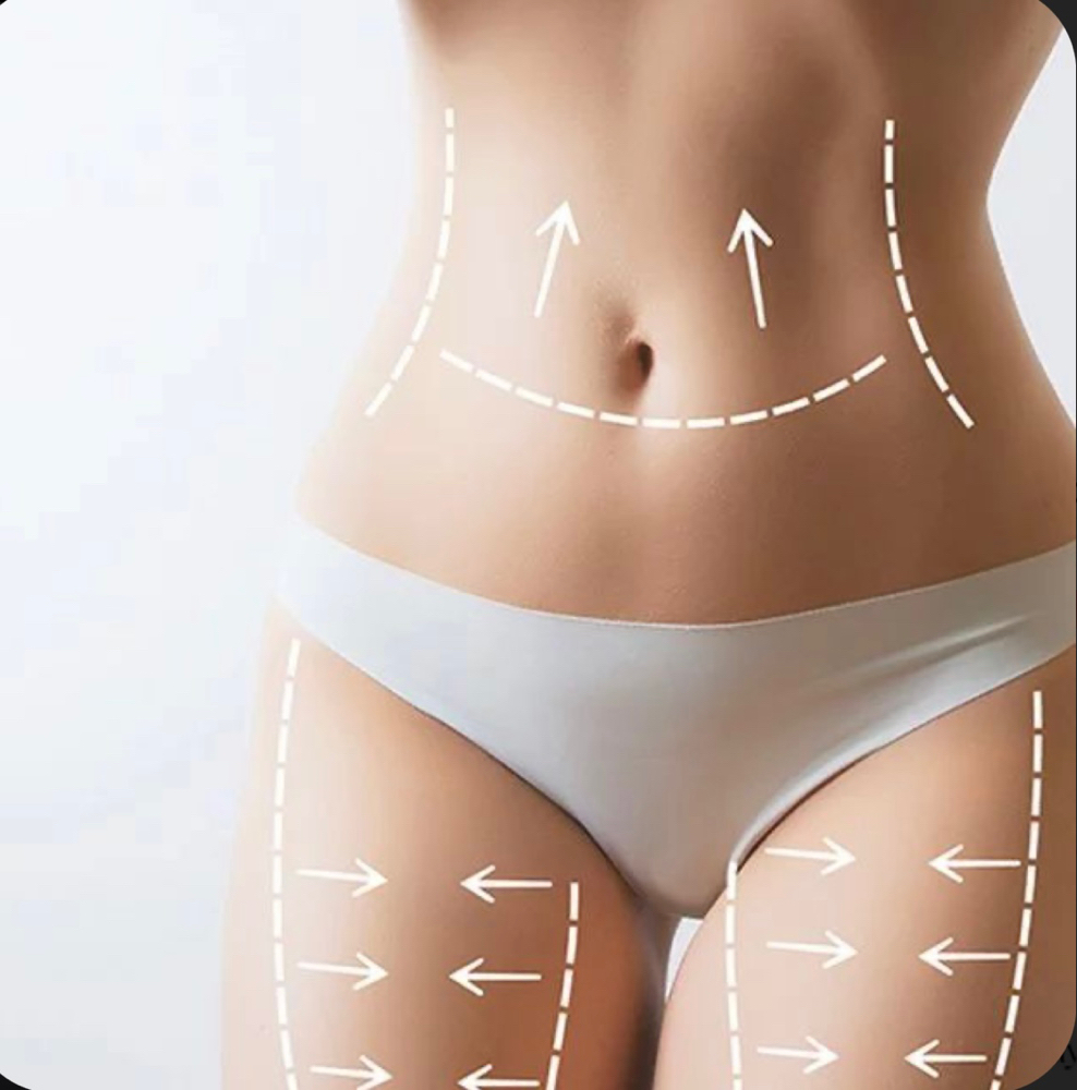 Body Sculpting