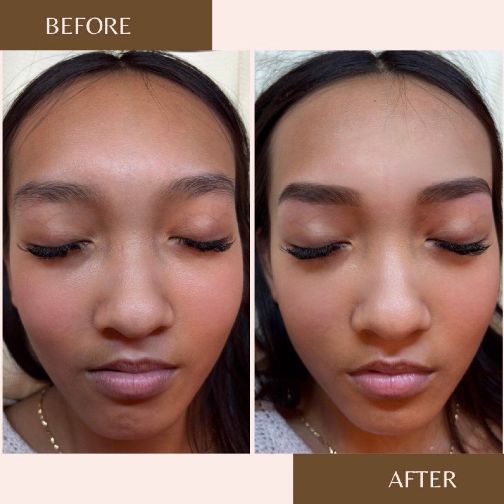 Brow Lamination