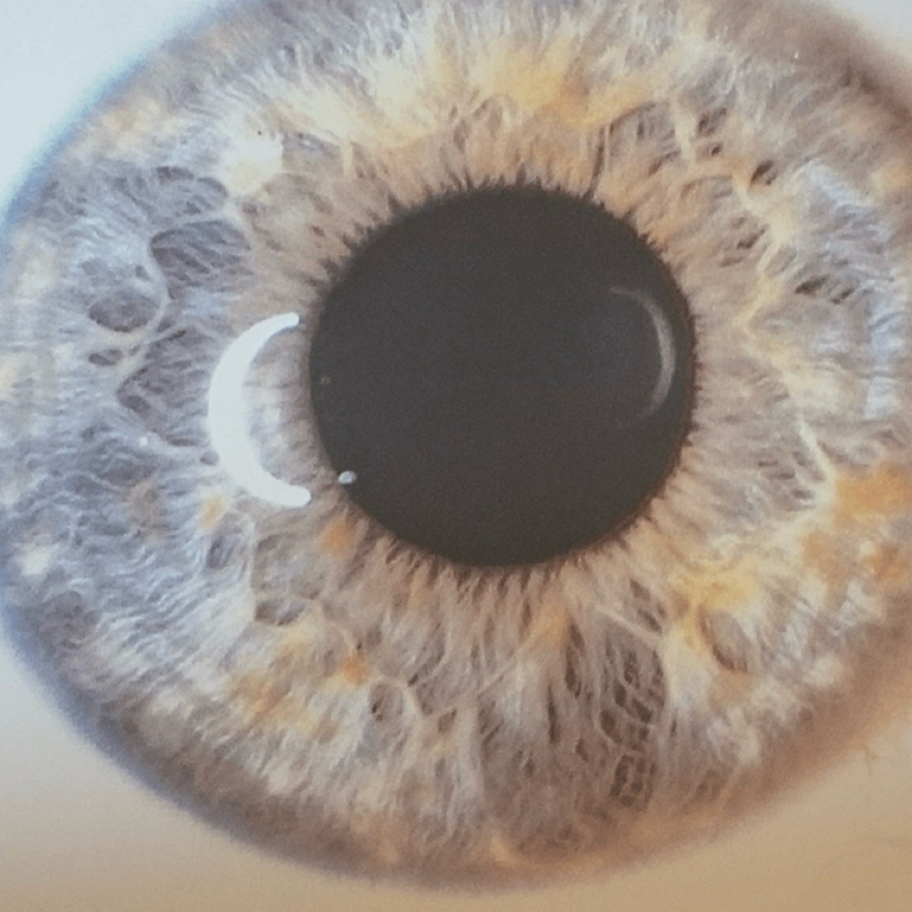 Holistic Iridology Assessment at Boost in Life Holistic Healing in Houston, TX