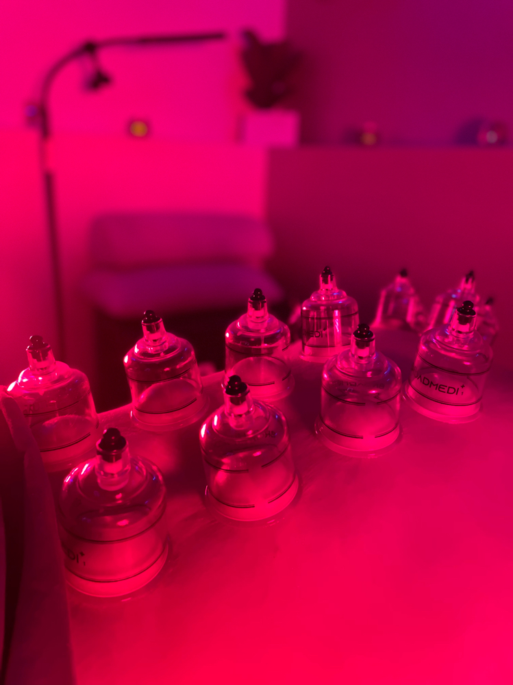 Cupping