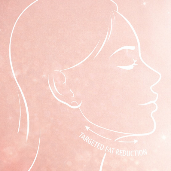 Kybella  Double-Chin Treatment at Home Haven Aesthetics, LLC in Edinburg, TX
