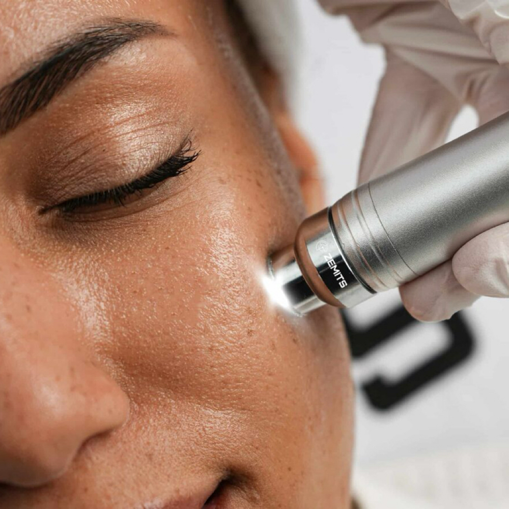 Hydro-Diamond Glow at Luxe Skin & Lash Studio in Tewksbury, MA