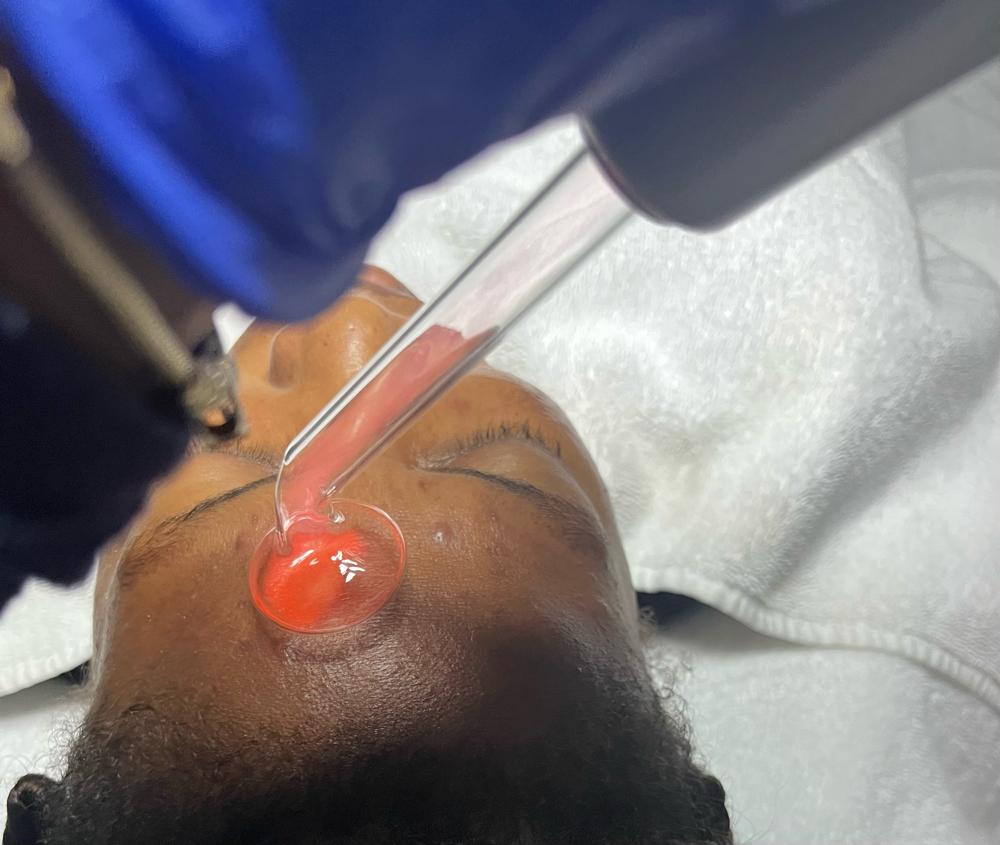 High Frequency Facial