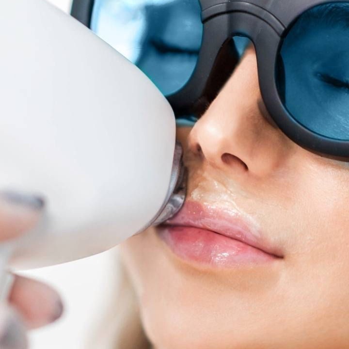 Laser Hair Removal (Lip) at Fade + Form Skin Aesthetics in Cartersville, GA
