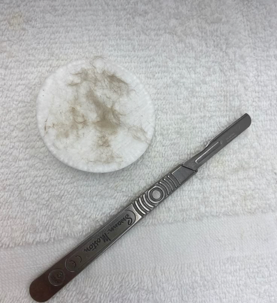 Dermaplane Facial
