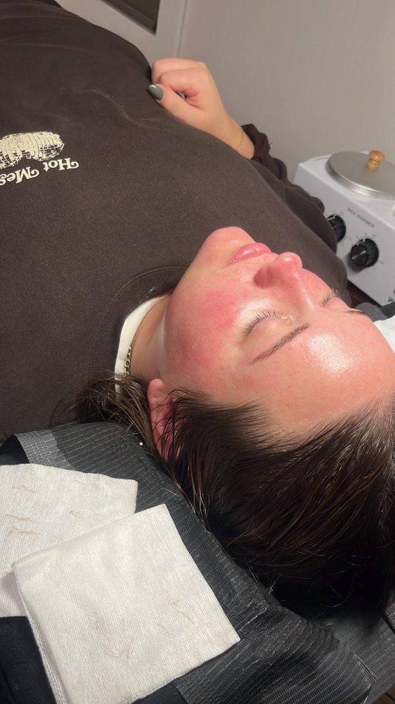 Dermaplane Facial