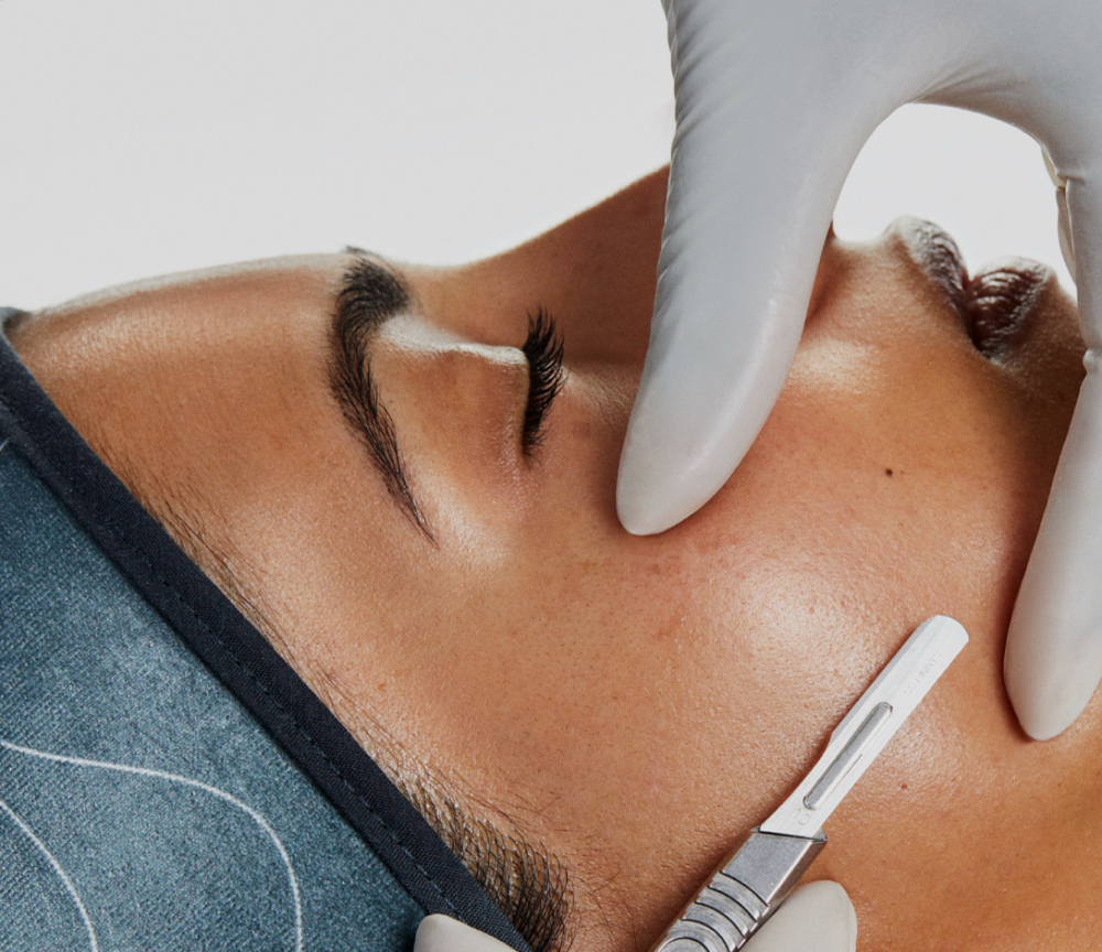 SKNN Dermaplaning (coming soon)