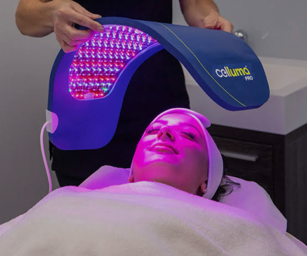 Celluma LED Light Therapy -Add On