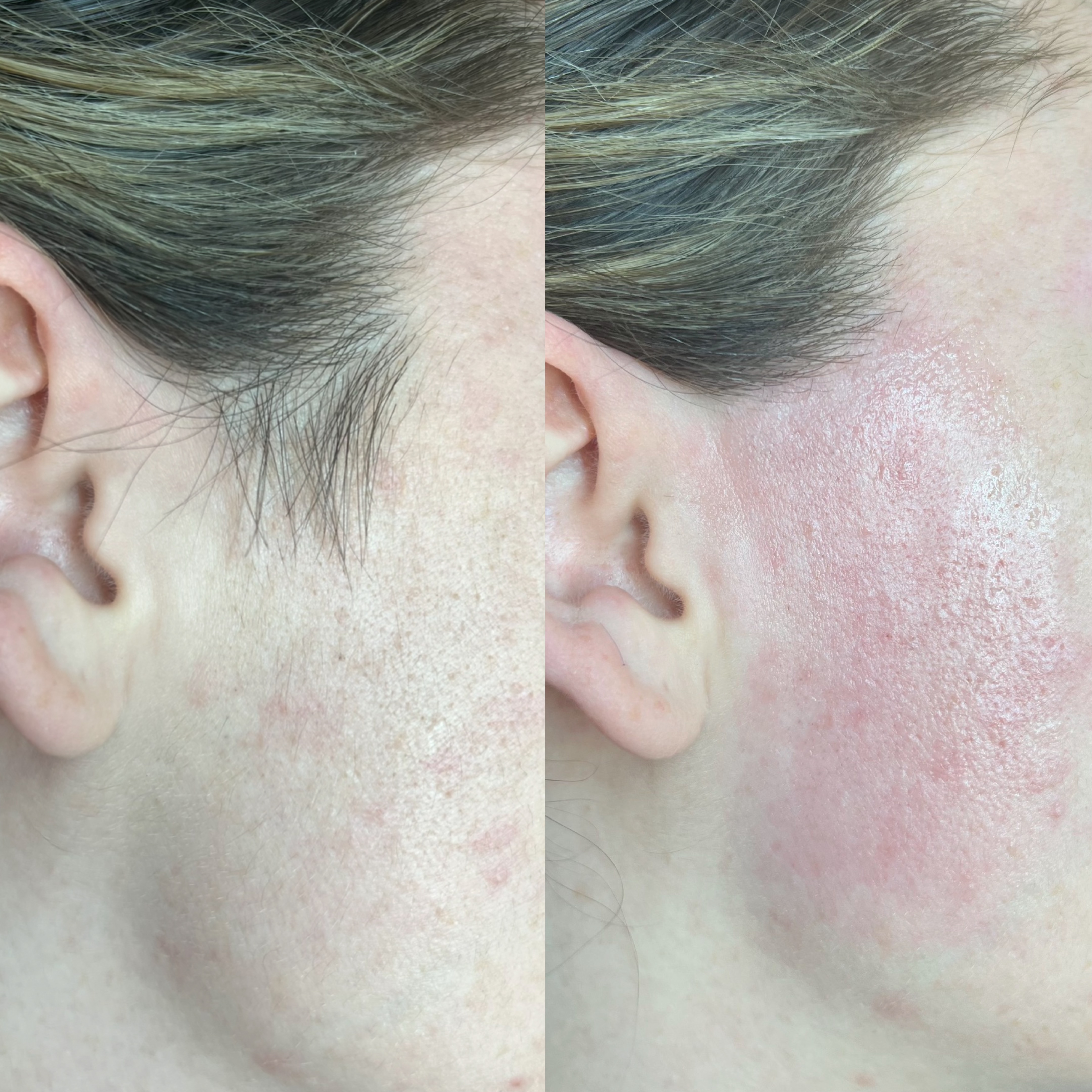 Full Face Wax at Pink Crab Wax Bar in Las Vegas, NV