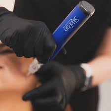 Collagen Induction “Microneedling”