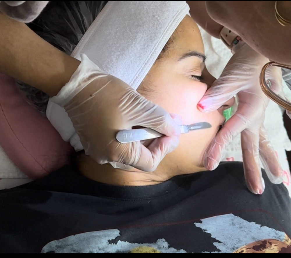 Dermaplaning + Lilyluxe Facial