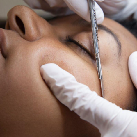 Dermaplaning treatment at Blossoms HTX Hair Studio in Spring, TX