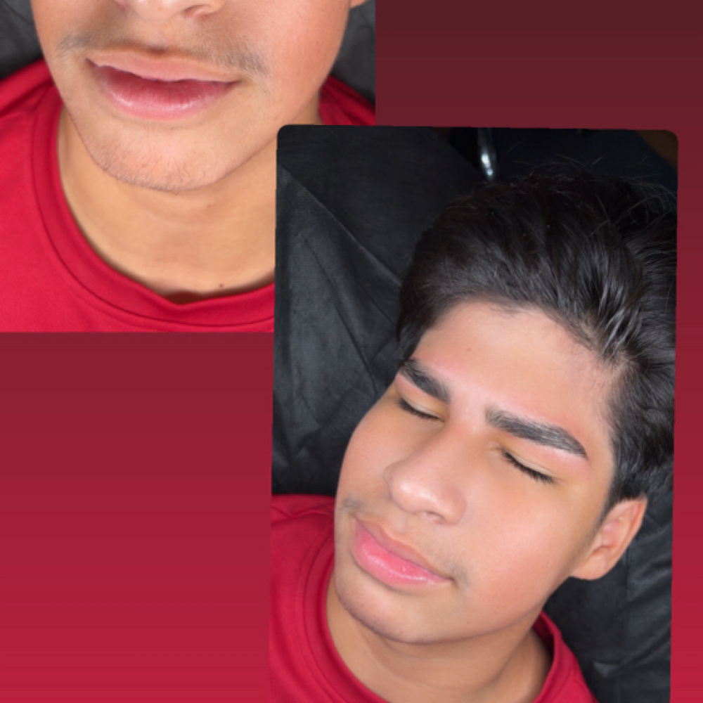 Hydrofacial at D’luxe esthetics in Orange Cit, FL