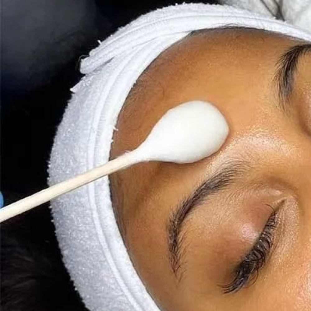 Gentle Bloom Peel - Lv 1