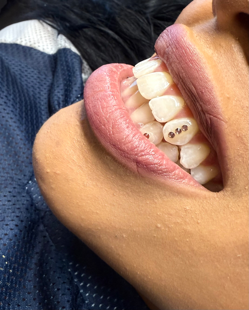 Tooth Gems💎