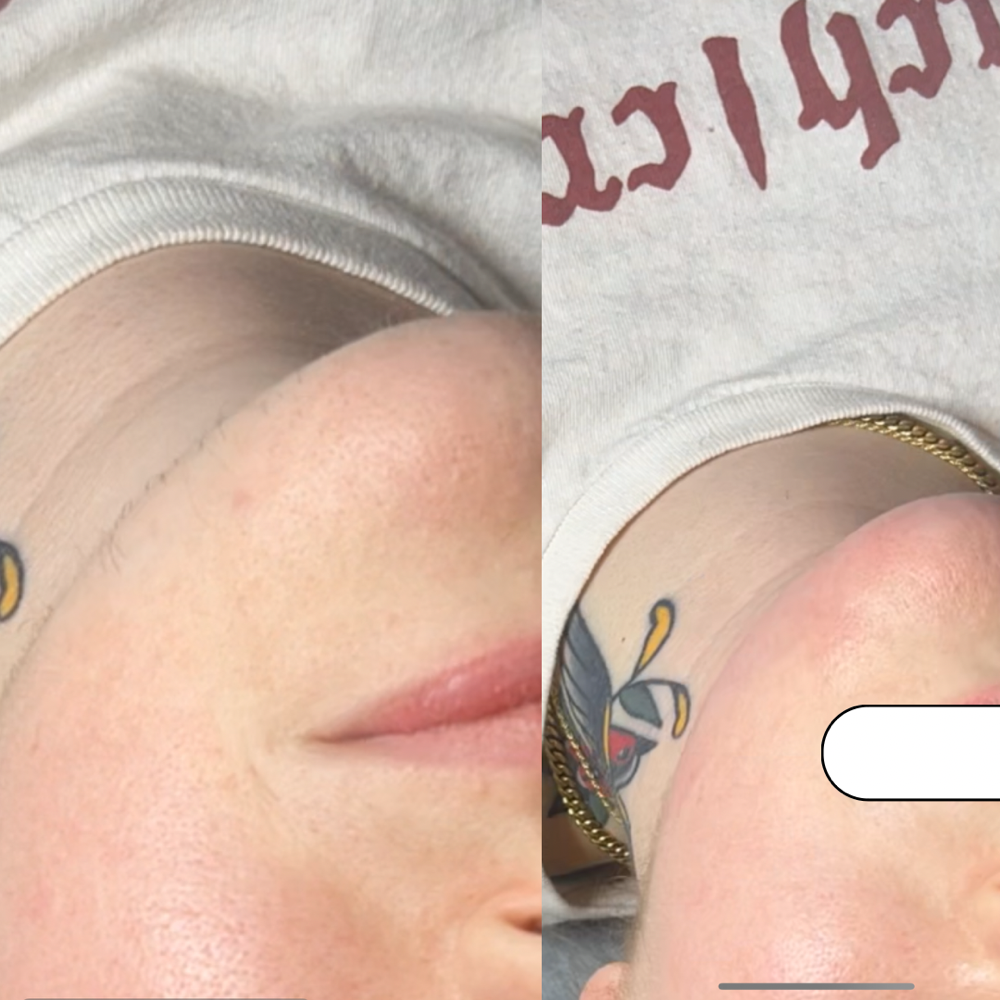 Chin Wax