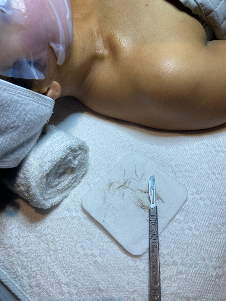 Dermaplaning Only