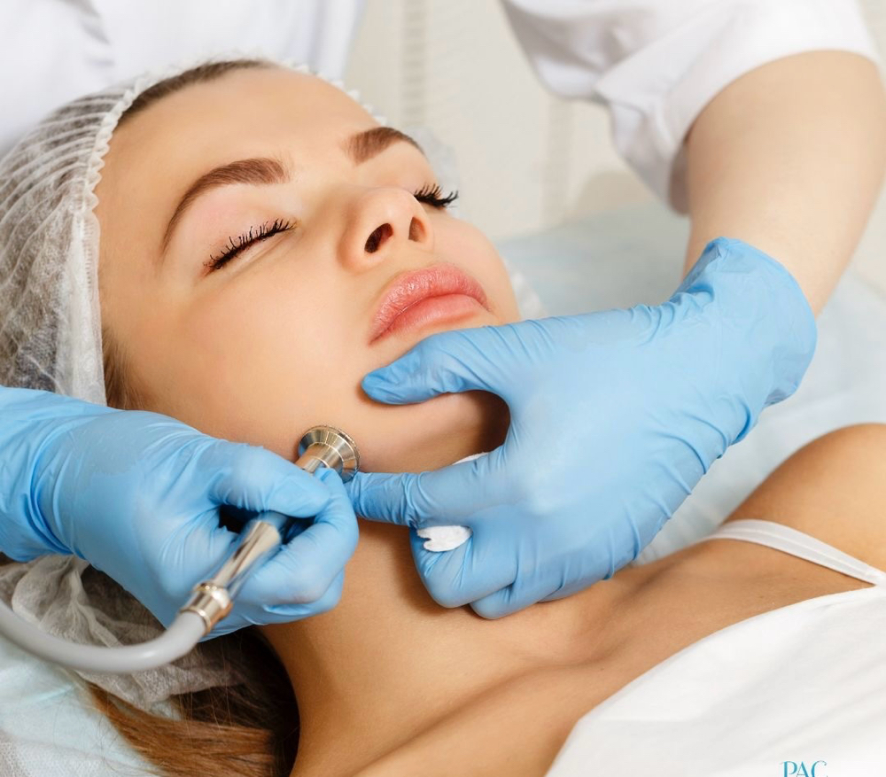 Microdermabrasion