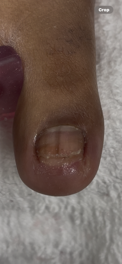 FREE PEDICURE CONSULTATION