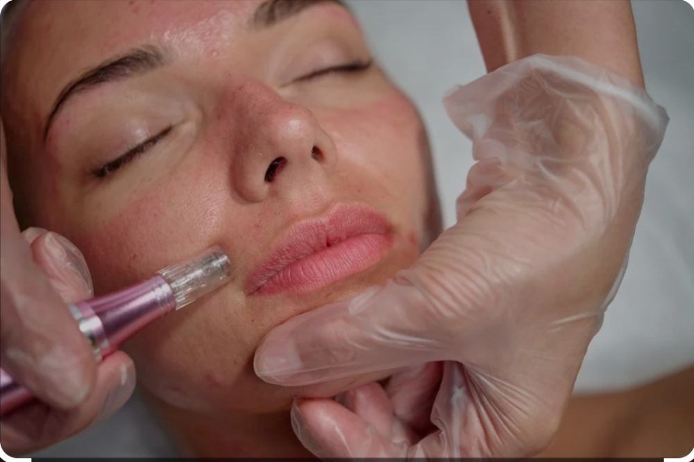 R&B Microneedle