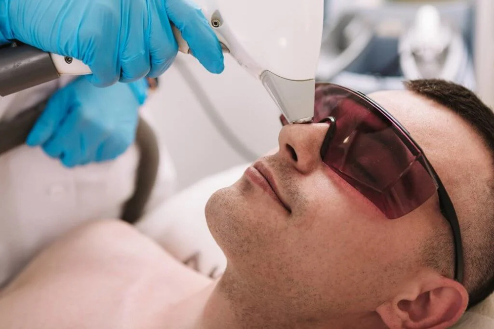 Nose Laser Hair Removal