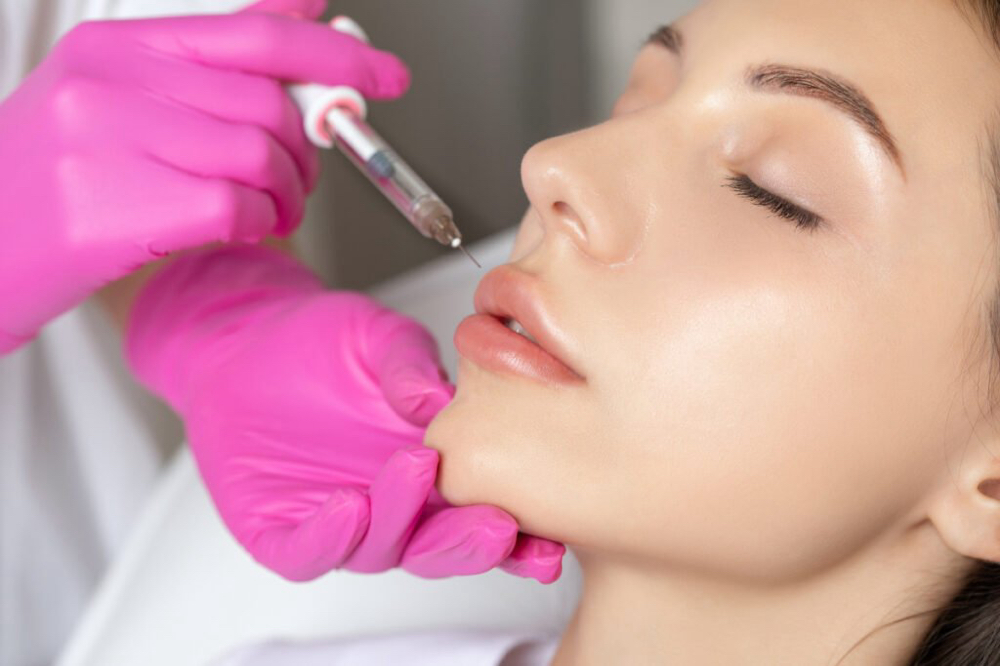 Lip Flip Enhancement