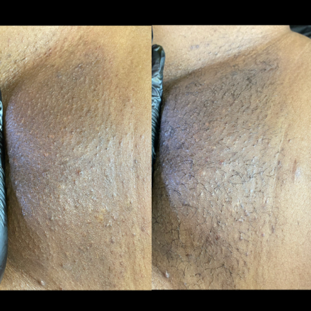 Brazilian Wax (4-6 weeks) at Waxxaholics Beauty & Body in Grand Prairie, TX