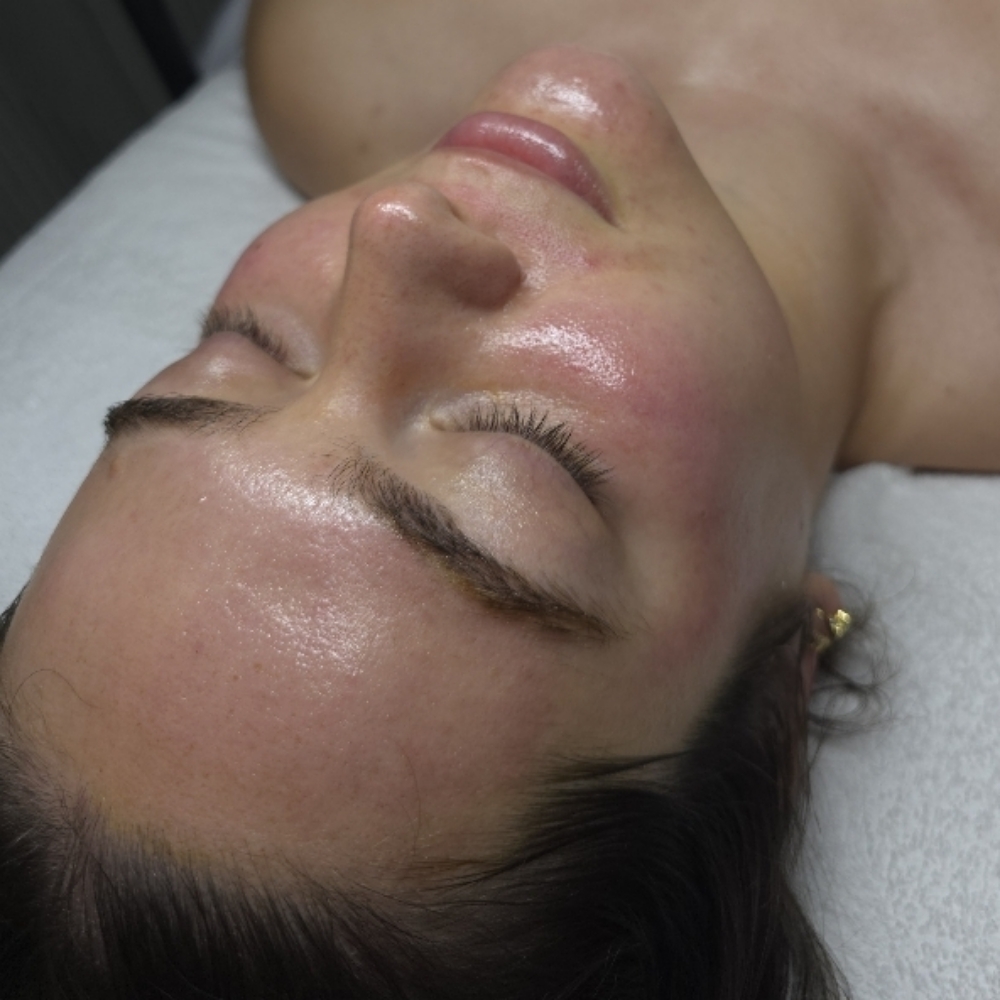 A1 Microneedling Facial at Stephs A1 Beauty Bar in Southwest Ranches, FL