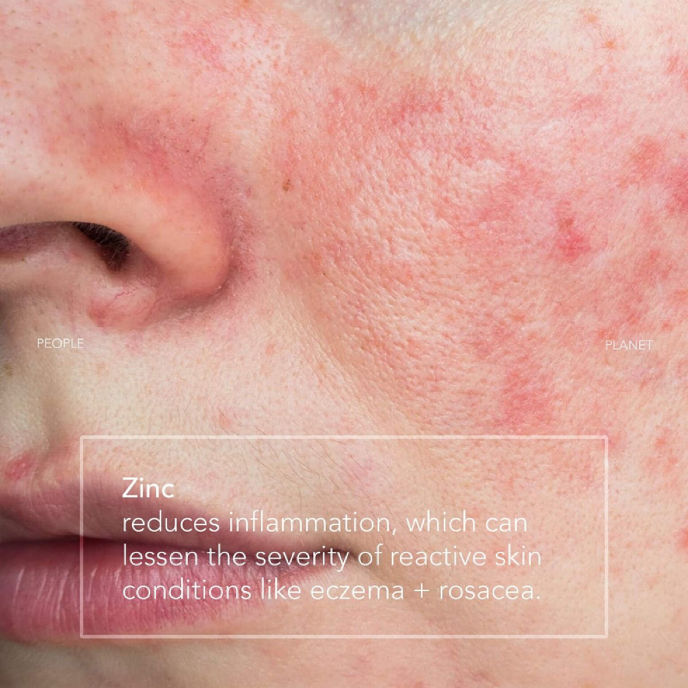 Sensitive Skin Facial at Hyde Park Esthetics in Tampa, FL