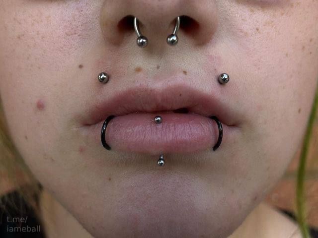 Angel Bites