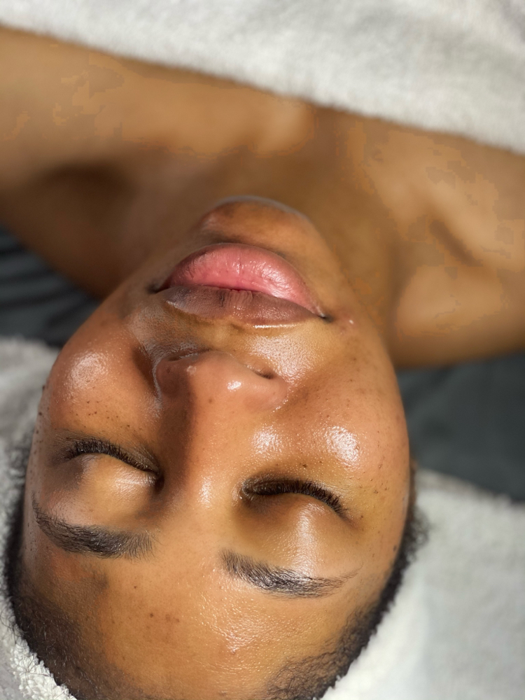 Dermaplaning Facial