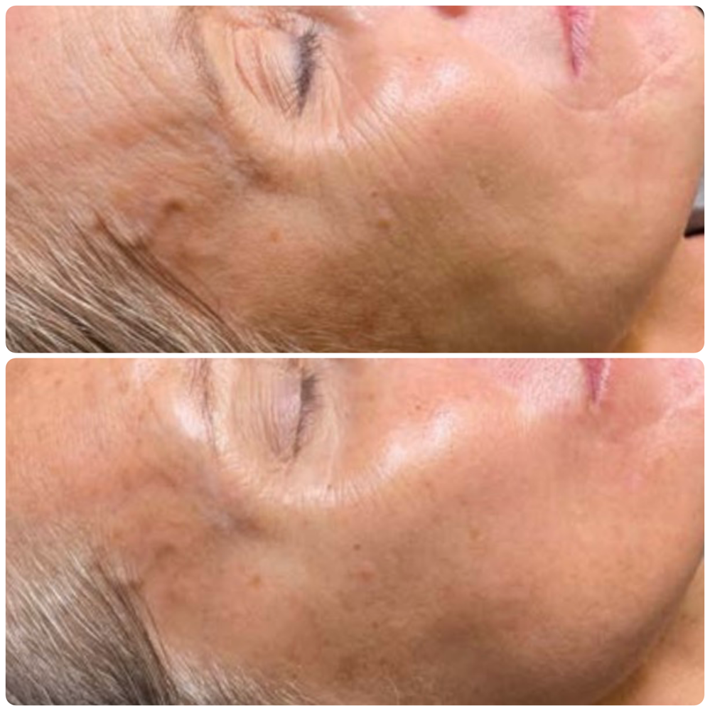 Swich Treatment