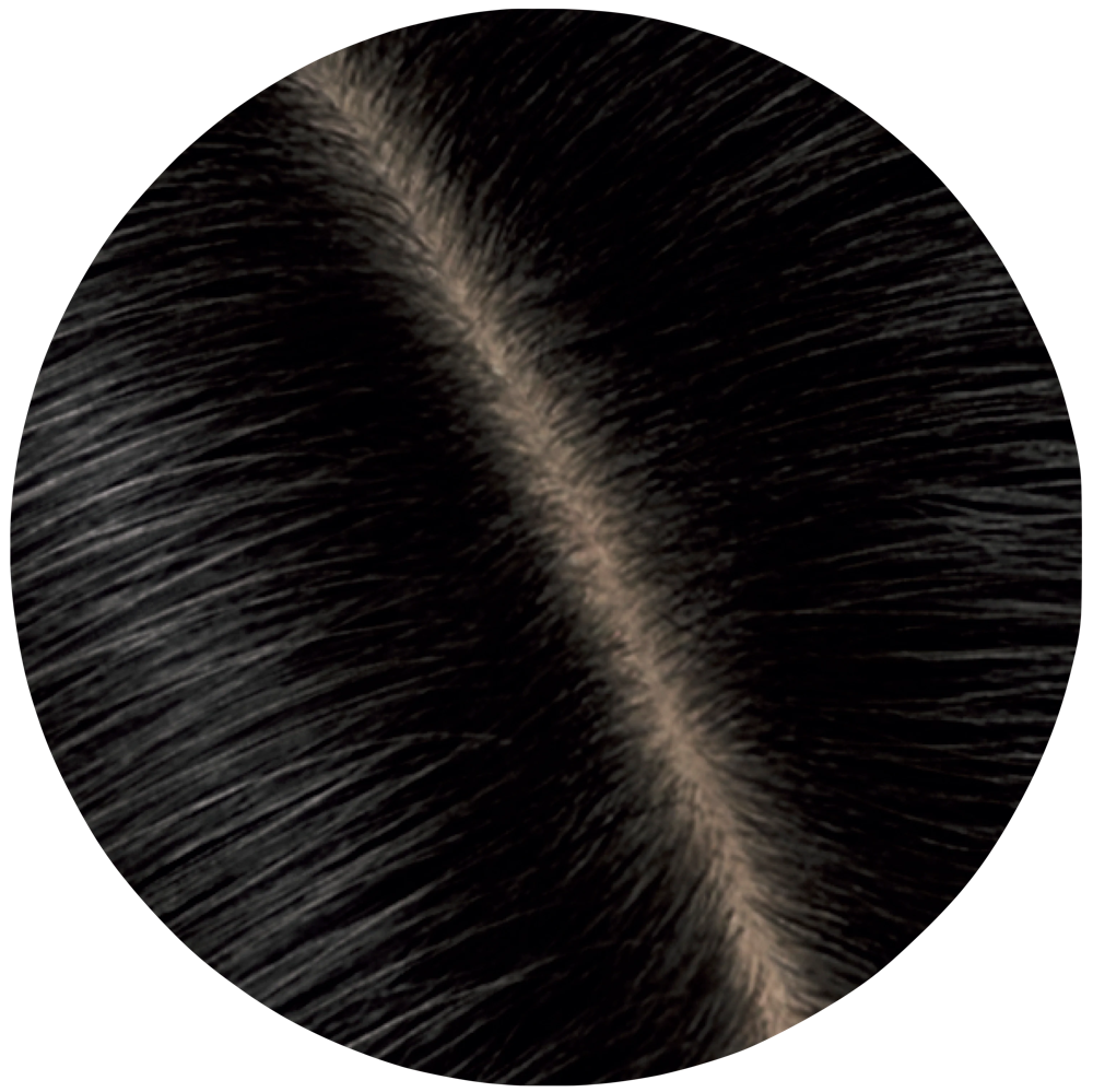 Root Retouch