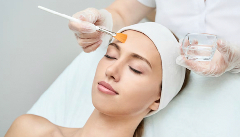 Chemical Peel at Lace Esthetics in Chino Valley, AZ