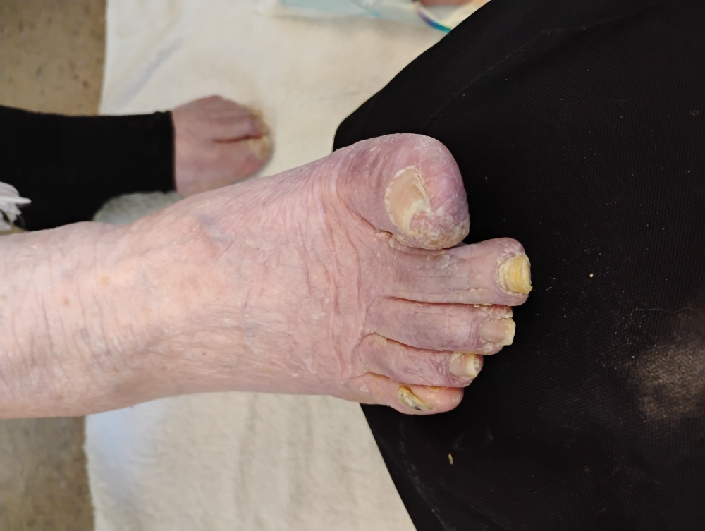 Footlogix Medi-Pedi at Deezgoodnailz in Timonium, MD