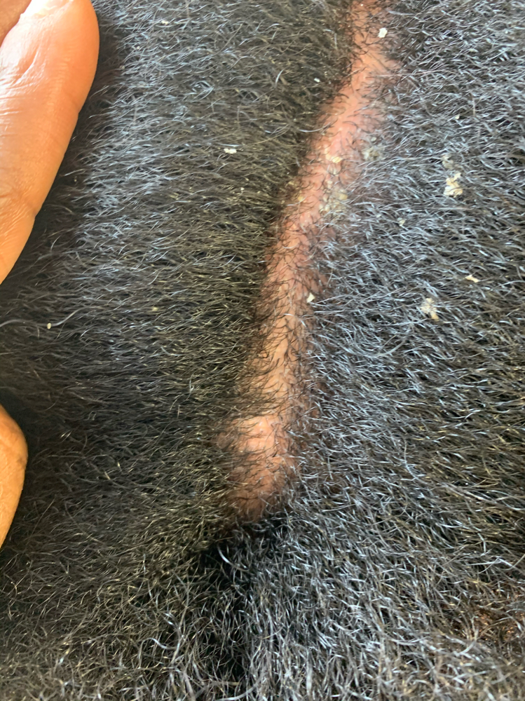 SCALP TREAMENTS at BEAUTY SPECIALIST in Brooklyn, NY
