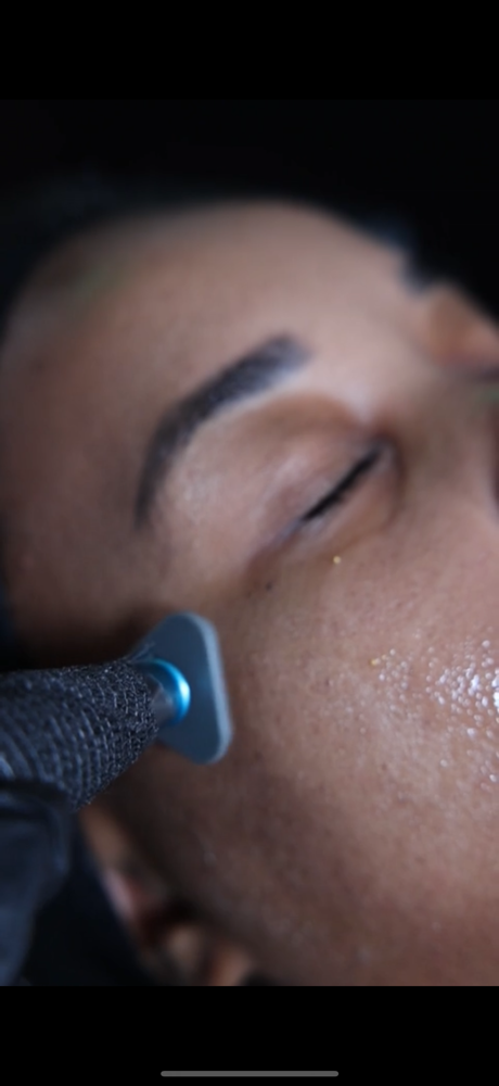 Advanced Treatments