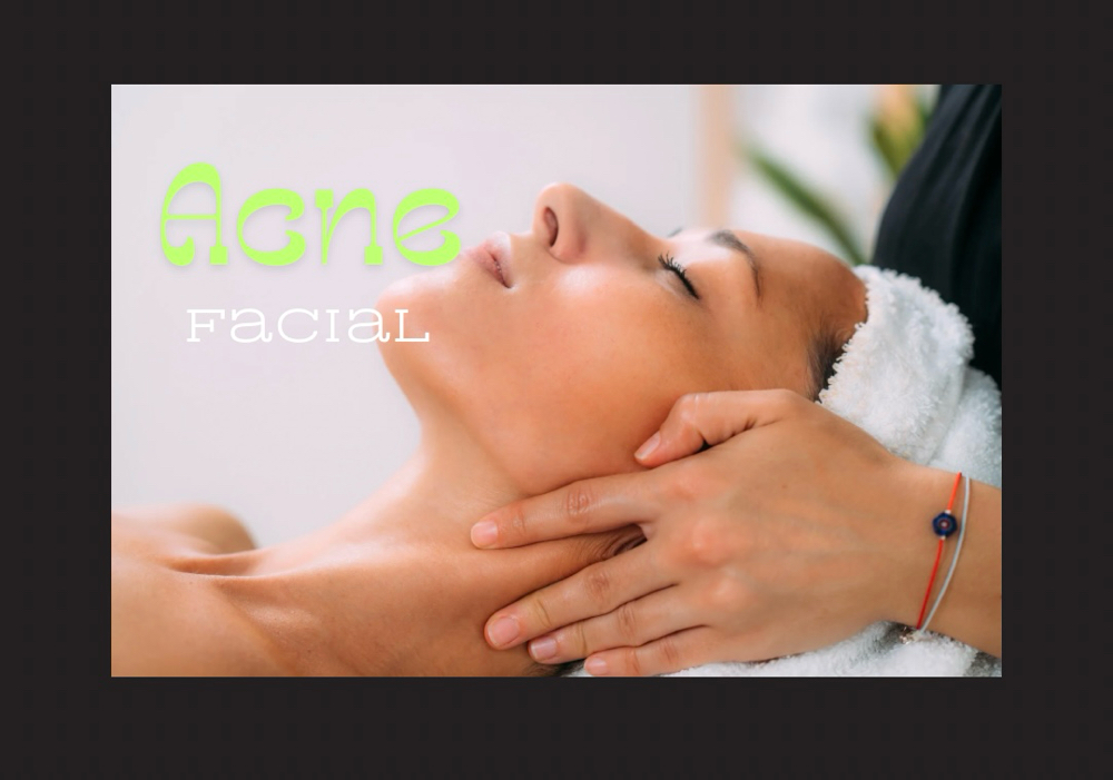 Acne Facial