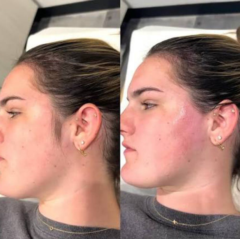 Sideburn Wax at Angelic Skin & Body in Oak Park, IL