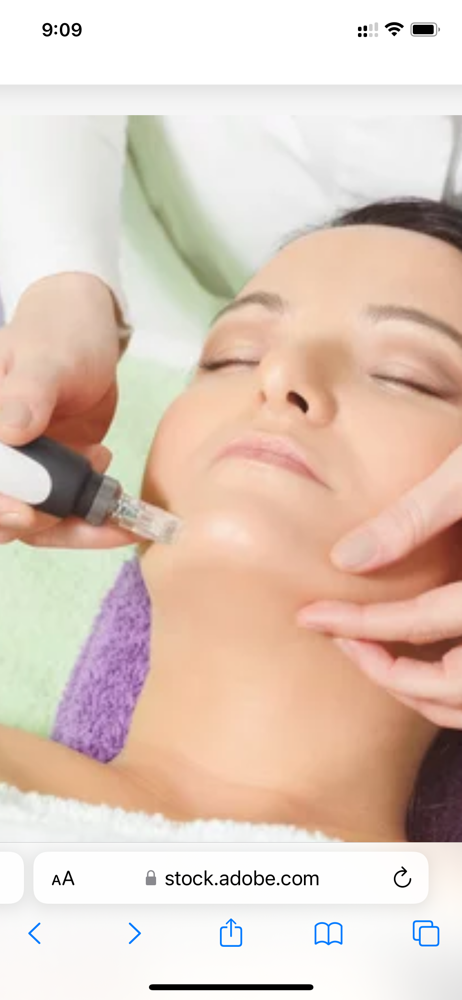 Microneedling